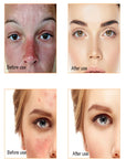 Vitamin C Serum For Face Moisturizing